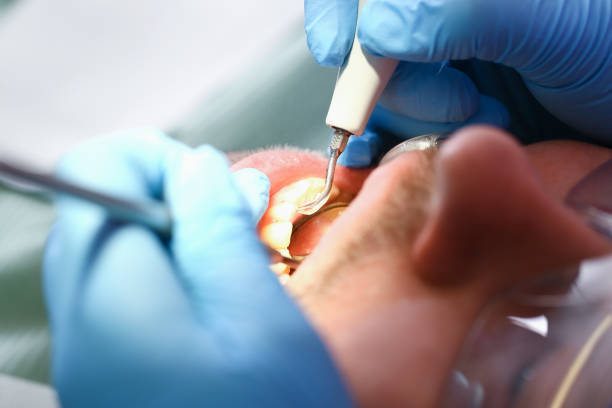 Best Broken or Chipped Tooth Repair in Woodside, PA